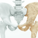 Kości zdrowe i zaatakowane przez osteoporozę