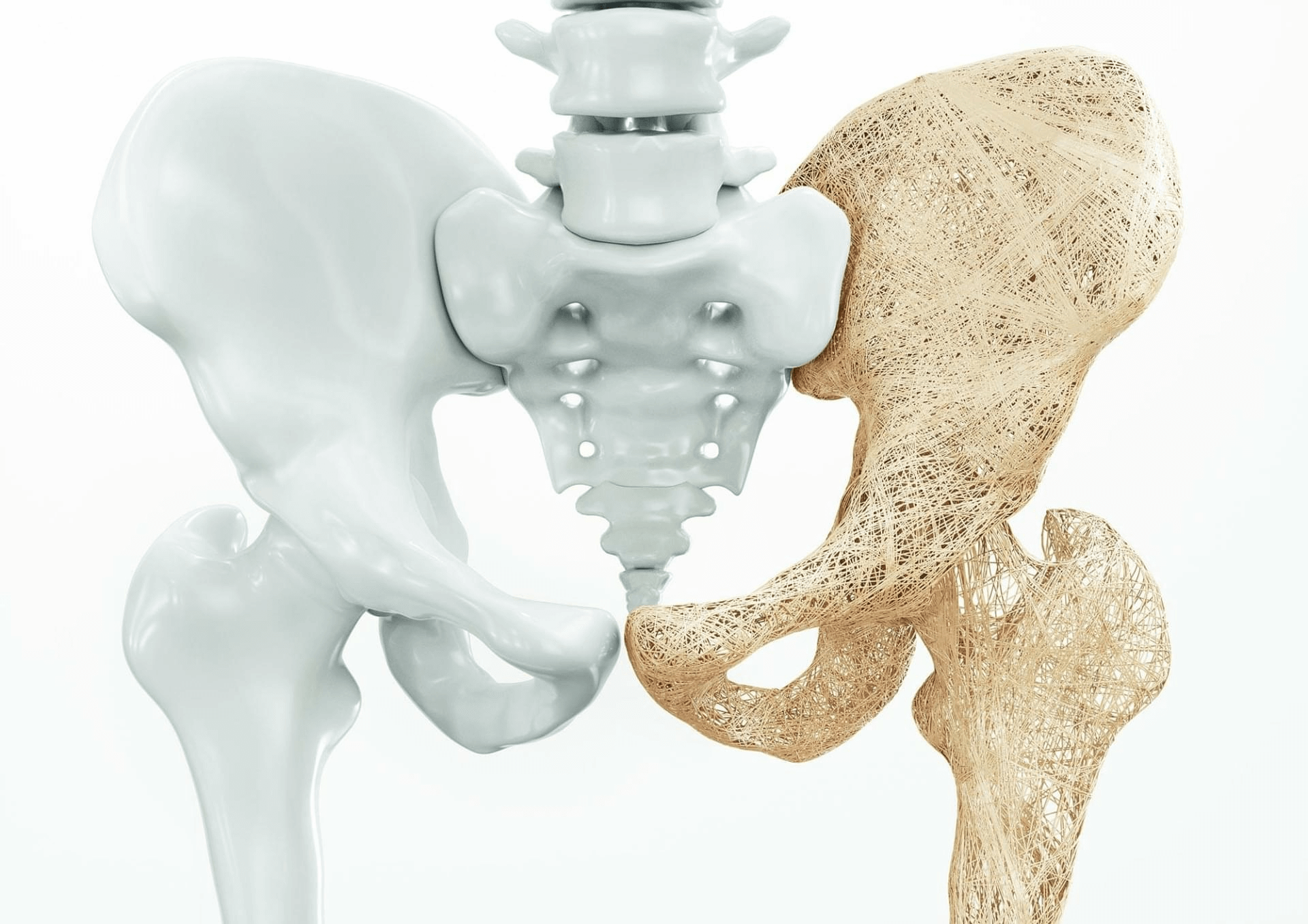 Kości zdrowe i zaatakowane przez osteoporozę